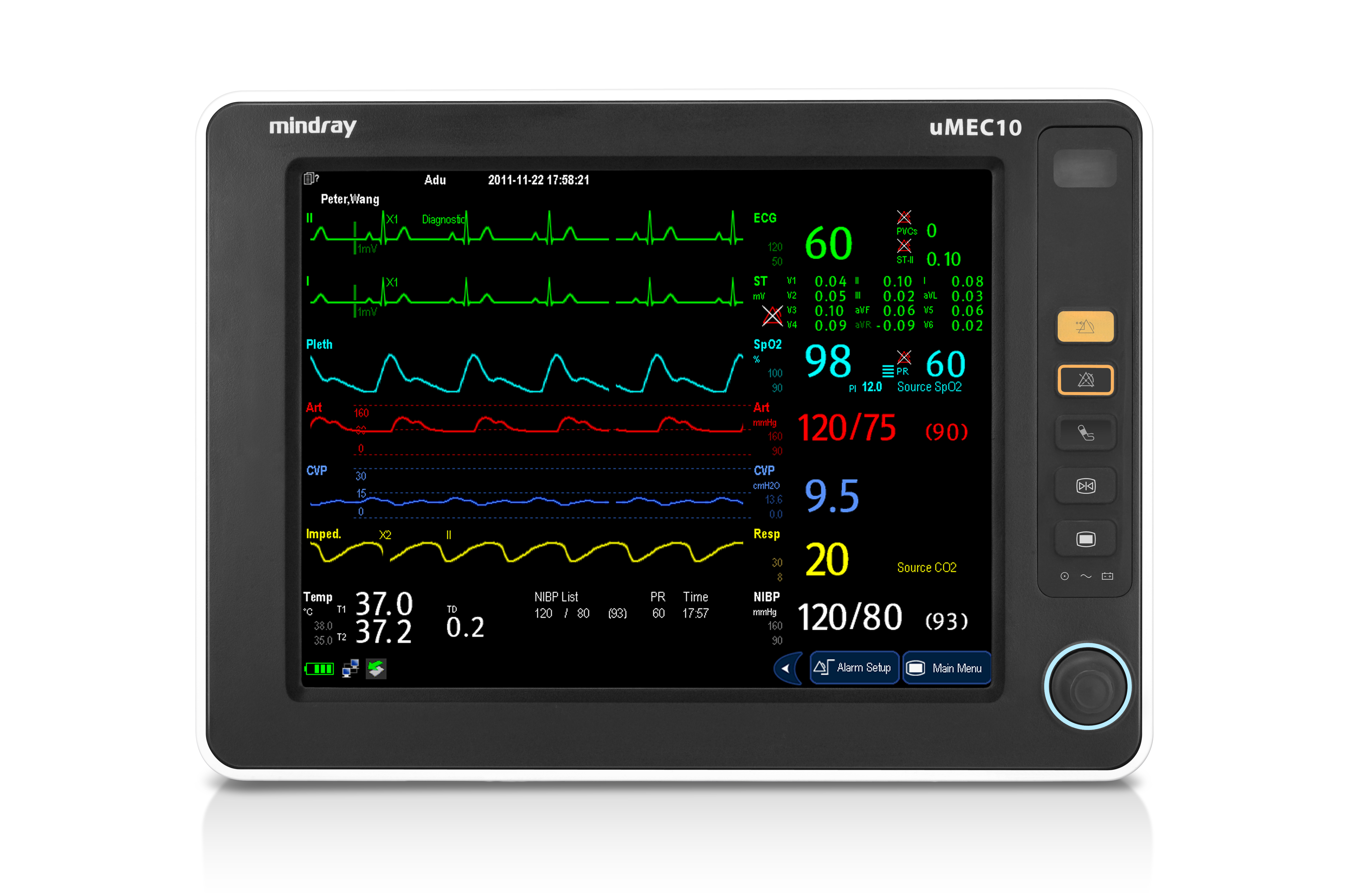 Mindray uMEC 10 Patientenmonitor "Touch" mit Zubehör