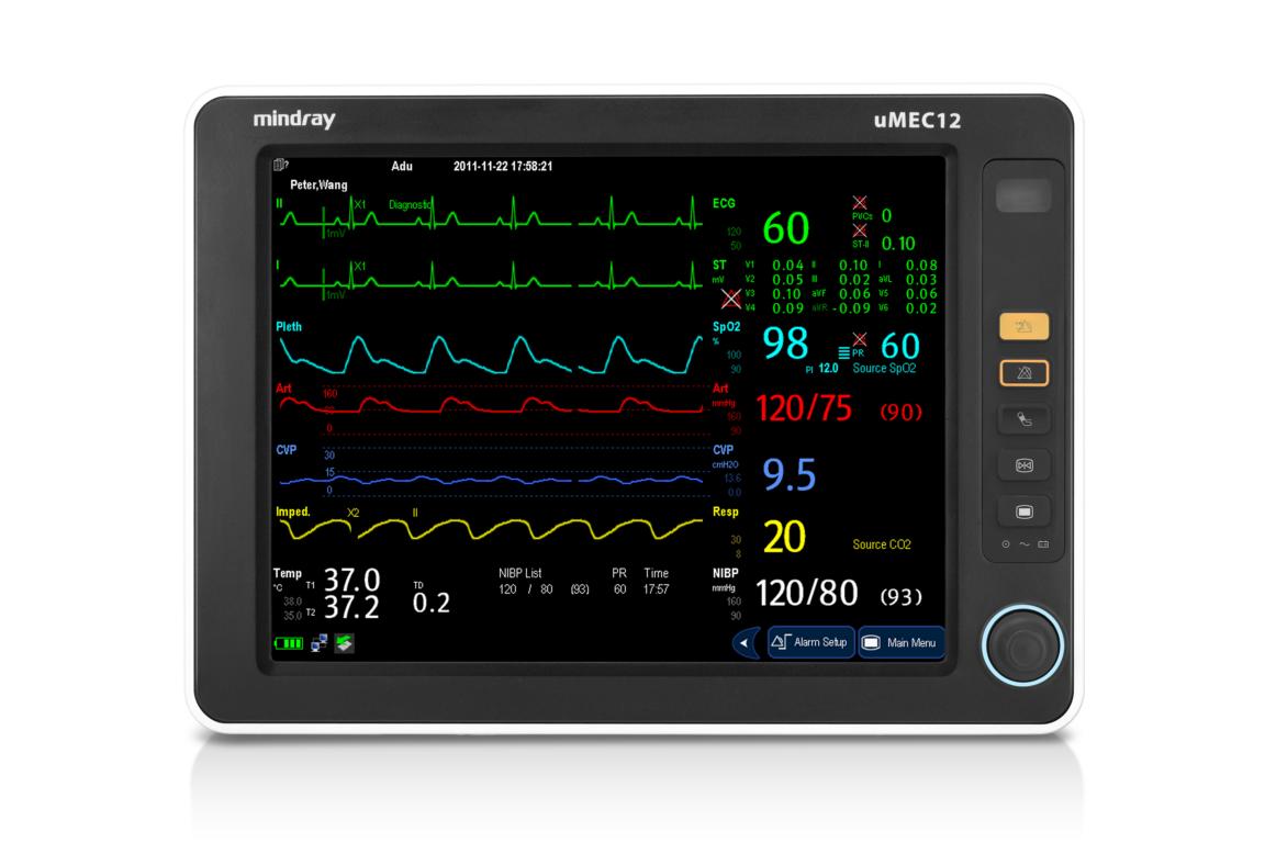 Mindray uMEC 12 "TIVA" Patientenmonitor mit etCO2